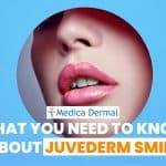 medica-dermal-juvederm-ultra-smile