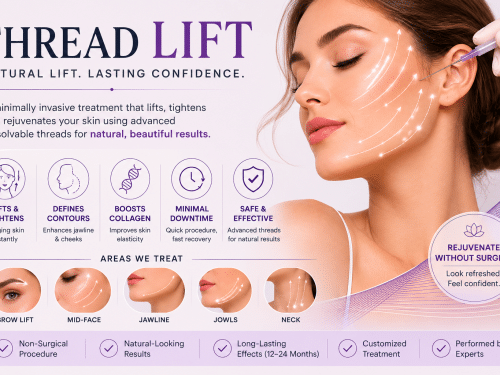 Understanding Thread Lifts