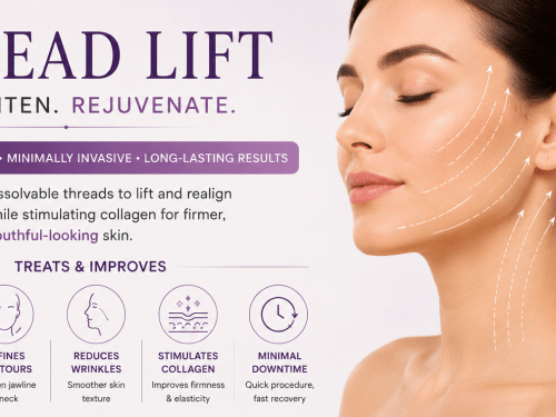 Understanding Thread Lifts
