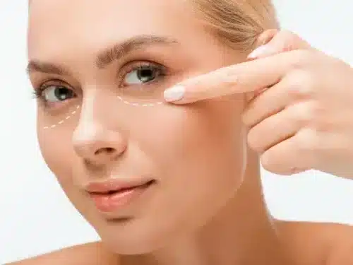 Restylane For Under Eye Bags Explained – How Does Restylane Help